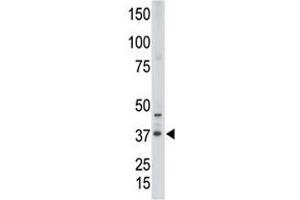 Western Blotting (WB) image for anti-Caudal Type Homeobox 2 (CDX2) (AA 1-30) antibody (ABIN3030336)
