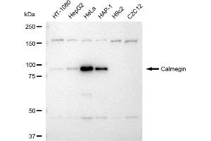 Western blotting analysis using Calmegin antibody (ABIN7797841). (Recombinant Calmegin 抗体)