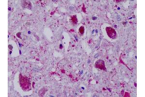 Anti-PPYR1 antibody IHC of human brain, substantia nigra. (NPY4R 抗体  (Cytoplasmic Domain))