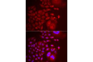 Immunofluorescence analysis of U2OS cells using TRAPPC10 antibody. (TRAPPC10 抗体)