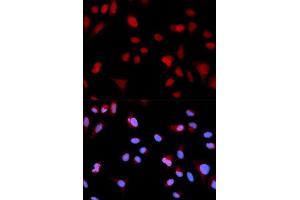 Immunofluorescence analysis of MCF-7 cells using Phospho-ABL1-Y204 antibody (ABIN5969866). (ABL1 抗体  (pTyr204))