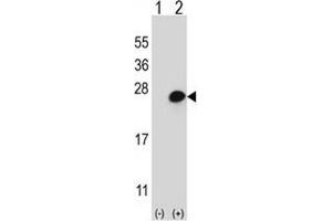 Western blot analysis of MGMT (arrow) using rabbit polyclonal MGMT Antibody (N-term). (MGMT 抗体  (N-Term))