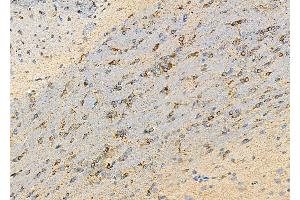 ABIN6259279 and ABIN6275588 at 1/100 staining Rat brain tissue by IHC-P. (SLC24A3 抗体  (Internal Region))