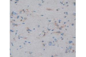 IHC-P analysis of Human Brain Tissue, with DAB staining. (HSP27 抗体  (AA 2-205))