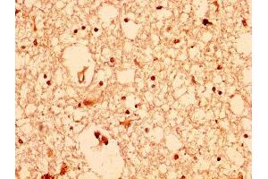 Immunohistochemistry (IHC) image for anti-V-Akt Murine Thymoma Viral Oncogene Homolog 1 (AKT1) (AA 1-480) antibody (ABIN7167024)