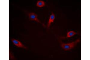 Immunofluorescent analysis of Alpha-synuclein (pS129) staining in HEK293T cells. (SNCA 抗体  (C-Term, pSer129))