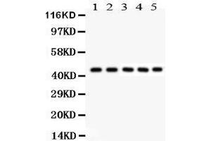 Anti- PIM1Picoband antibody, Western blotting All lanes: Anti PIM1  at 0. (PIM1 抗体  (C-Term))
