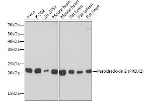 Western blot analysis of extracts of various cell lines, using Peroxiredoxin 2 (PRDX2) (PRDX2) Rabbit mAb (ABIN7269234) at 1:1000 dilution. (Peroxiredoxin 2 抗体)