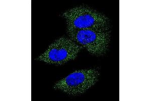 Confocal immunofluorescent analysis of M-CSF Antibody (Center) (ABIN390719 and ABIN2840996) with MDA-M cell followed by Alexa Fluor 488-conjugated goat anti-rabbit lgG (green). (M-CSF/CSF1 抗体  (AA 230-257))