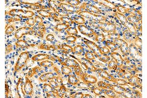 ABIN6262297 and ABIN6276874 at 1/100 staining Mouse kidney tissue by IHC-P. (HMBS 抗体  (Internal Region))