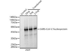 Western blot analysis of extracts of normal 293T cells and 293T transfected with Nucleoprotein Protein, using SARS-CoV-2 Nucleoprotein antibody (ABIN7269052) at 1:10000 dilution. (Nucleoprotein 抗体)