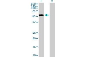 Western Blot analysis of SASS6 expression in transfected 293T cell line by SASS6 MaxPab polyclonal antibody. (SASS6 抗体  (AA 1-490))