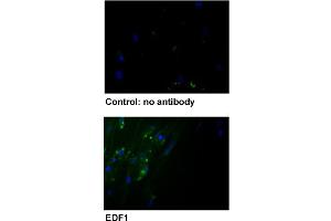 Immunofluorescent staining of human fibroblast with EDF1 polyclonal antibody . (EDF1 抗体  (AA 99-148))