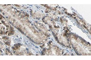 ABIN6276636 at 1/100 staining Human prostate tissue by IHC-P. (TNFRSF10B 抗体  (N-Term))
