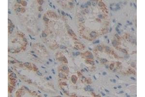 DAB staining on IHC-P; Samples: Human Kidney Tissue (LOR 抗体  (AA 210-295))