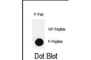 Dot blot analysis of anti-Phospho-IPF-pT11 Antibody (ABIN390000 and ABIN2839777) on nitrocellulose membrane. (PDX1 抗体  (pThr11))