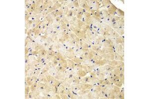 Immunohistochemistry of paraffin-embedded mouse heart using IDH1 antibody at dilution of 1:100 (400x lens). (IDH1 抗体)