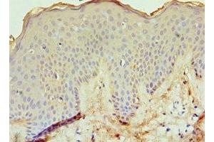 Immunohistochemistry of paraffin-embedded human skin tissue using ABIN7151764 at dilution of 1:100 (ECE1 抗体  (AA 471-770))