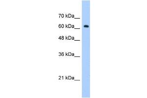 WB Suggested Anti-ZNF675 Antibody Titration:  1. (ZNF675 抗体  (C-Term))