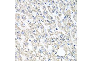 Immunohistochemistry (Paraffin-embedded Sections) (IHC (p)) image for anti-Ornithine Carbamoyltransferase (OTC) (AA 215-354) antibody (ABIN6145081)