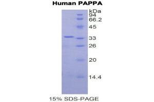 SDS-PAGE (SDS) image for Pregnancy-Associated Plasma Protein A, Pappalysin 1 (PAPPA) (AA 1270-1558) protein (His tag) (ABIN1878349) (PAPPA Protein (AA 1270-1558) (His tag))