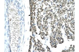 MORF4L1 antibody was used for immunohistochemistry at a concentration of 4-8 ug/ml to stain Myocardial cells (arrows) in Human Heart. (MORF4L1 抗体  (Middle Region))