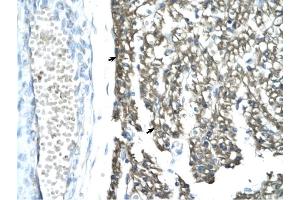 MORF4L1 antibody was used for immunohistochemistry at a concentration of 4-8 ug/ml to stain Myocardial cells (arrows) in Human Heart.