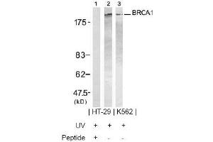 Image no. 2 for anti-Breast Cancer 1 (BRCA1) (Ser1423) antibody (ABIN197480) (BRCA1 抗体  (Ser1423))