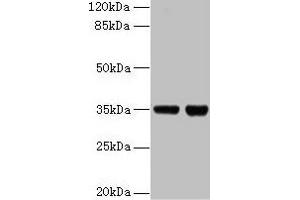 Western blot All lanes: ZBED1 antibody at 2 μg/mL Lane 1: EC109 whole cell lysate Lane 2: 293T whole cell lysate Secondary Goat polyclonal to rabbit IgG at 1/15000 dilution Predicted band size: 79 kDa Observed band size: 35 kDa (ZBED1 抗体  (AA 1-210))