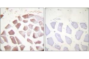 Immunohistochemistry analysis of paraffin-embedded human skeletal muscle, using Actin-pan (alpha/gamma) (Phospho-Tyr55/53) Antibody. (Actin 抗体  (pTyr55))