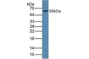 Detection of FDFT1 in Rat Liver Tissue using Polyclonal Antibody to Farnesyl Diphosphate Farnesyltransferase 1 (FDFT1) (FDFT1 抗体  (AA 269-417))