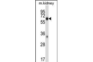 Mouse Map3k2 Antibody (N-term) (ABIN657838 and ABIN2846800) western blot analysis in mouse kidney tissue lysates (35 μg/lane). (MAP3K2 抗体  (N-Term))