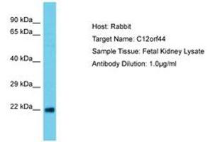 Image no. 1 for anti-Chromosome 12 Open Reading Frame 44 (C12orf44) (AA 29-78) antibody (ABIN6750653) (ATG101 抗体  (AA 29-78))