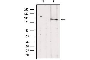 Western blot analysis of extracts from Hela, using TELO2 antibody. (TELO2 抗体  (Internal Region))