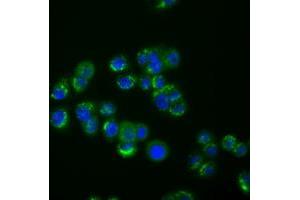 Image no. 1 for anti-Interferon-Induced Protein with Tetratricopeptide Repeats 1 (IFIT1) antibody (ABIN1498803) (IFIT1 抗体)