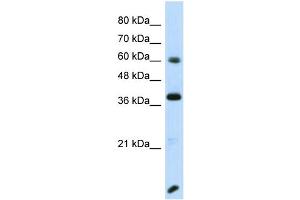 Host:  Rabbit  Target Name:  RFX4  Sample Type:  Transfected 293T Whole Cell lysates  Antibody Dilution:  1. (RFX4 抗体  (N-Term))