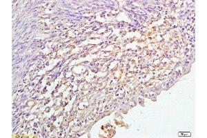 Immunohistochemistry (Paraffin-embedded Sections) (IHC (p)) image for anti-Cytochrome P450, Family 17, Subfamily A, Polypeptide 1 (CYP17A1) (AA 24-65) antibody (ABIN720071)