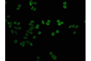 Immunofluorescence staining of HepG2 cells with nme1HU at 1:1, counter-stained with DAPI. (Histone H1-Like (LOC107807853) 抗体)