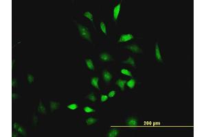 Immunofluorescence of monoclonal antibody to CBS on HeLa cell. (CBS 抗体  (AA 1-100))