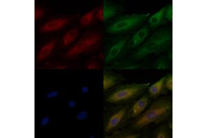 ABIN6260576 and ABIN6276962 staining  cells by IF/ICC. (CD151 抗体  (N-Term))