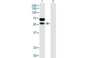 Western Blot analysis of CHD2 expression in transfected 293T cell line by CHD2 MaxPab polyclonal antibody. (CHD2 抗体  (AA 1-501))