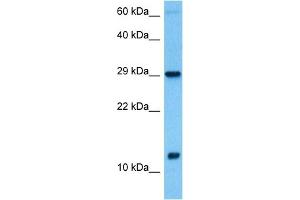 Host:  Rabbit  Target Name:  MRPS6  Sample Tissue:  Human Testicular Tumor lysates  Antibody Dilution:  1ug/ml (MRPS6 抗体  (C-Term))