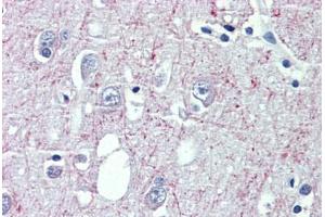 Brain, cortex, Human: Formalin-Fixed, Paraffin-Embedded (FFPE) (GABBR1 抗体  (AA 947-961))