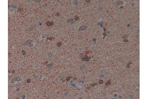 Detection of PAK1 in Human Brain Tissue using Polyclonal Antibody to p21 Protein Activated Kinase 1 (PAK1) (PAK1 抗体  (AA 252-501))