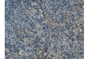 Immunohistochemistry (IHC) image for anti-Superoxide Dismutase 1, Soluble (SOD1) (AA 2-153) antibody (ABIN7443155)