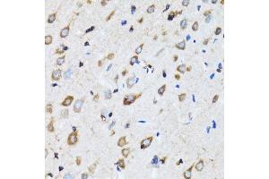 Immunohistochemistry of paraffin-embedded rat brain using NDE1 antibody.