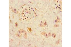 Immunohistochemistry of paraffin-embedded human placenta tissue using ABIN7165672 at dilution of 1:100 (JARID2 抗体  (AA 1-159))