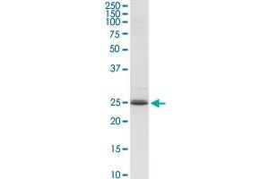 ARHGDIA MaxPab rabbit polyclonal antibody. (ARHGDIA 抗体  (AA 1-204))