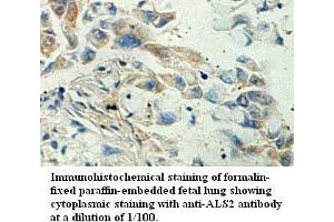 Image no. 1 for anti-Amyotrophic Lateral Sclerosis 2 (Juvenile) (ALS2) antibody (ABIN1574645) (ALS2 抗体)
