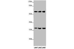 Western blot All lanes: MAOB antibody at 9 μg/mL Lane 1: Mouse liver tissue Lane 2: HepG2 whole cell lysate Lane 3: A549 whole cell lysate Secondary Goat polyclonal to rabbit IgG at 1/10000 dilution Predicted band size: 59, 47 kDa Observed band size: 59, 27 kDa (Monoamine Oxidase B 抗体  (AA 2-489))